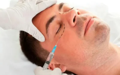 Transformando Tu Mirada: Ácido Hialurónico para Ojeras en Málaga y Fuengirola