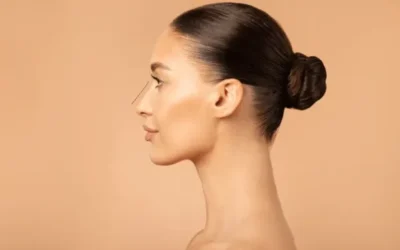 Endolift: Innovación mínimamente invasiva para redefinir la papada